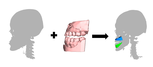 CBCT-IOS registration