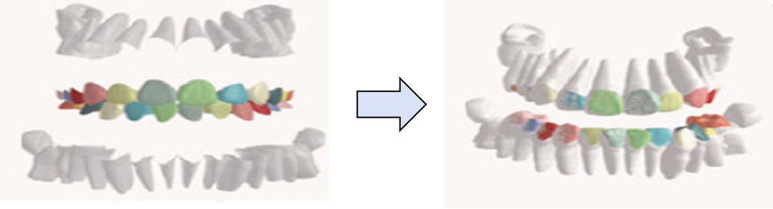cbct-image